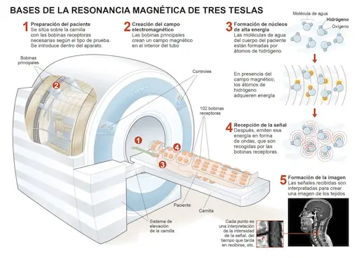 Bases de la Resonancia Magnética- Infografía