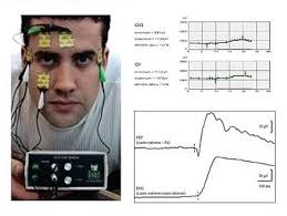 Electrooculografía